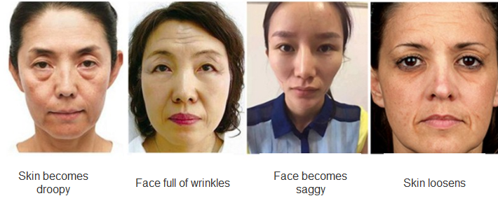 aging symptoms