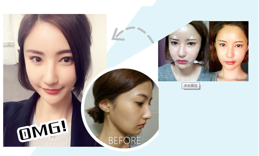 forehead filling case two